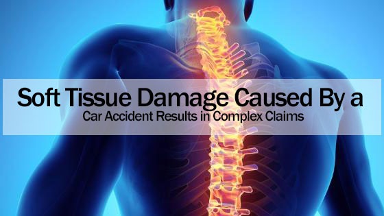 Soft Tissue Damage Caused By a Car Accident
