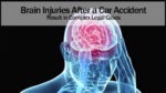Brain Injuries After a Car Accident Result in Complex Legal Cases