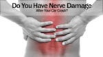 Do You Have Nerve Damage After Your Car Crash