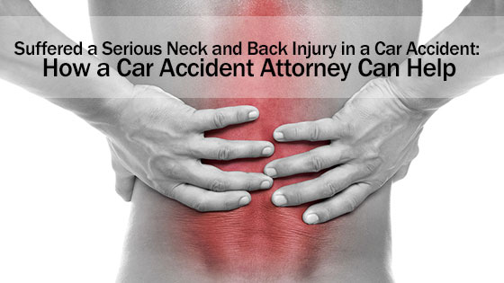 Suffered a Serious Neck and Back Injury in a Car Accident: How a Car Accident Attorney Can Help