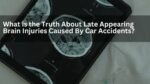 What is the Truth About Late Appearing Brain Injuries Caused By Car Accidents